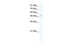 Aviva Systems Biology Corp SIRT7 Antibody - C-terminal region (ARP32406_P050)