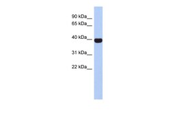 Aviva Systems Biology Corp NEUROD4 Antibody - middle region (ARP32415_P050)