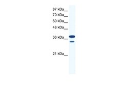 Aviva Systems Biology Corp LHX3 Antibody - middle region (ARP32443_P050)