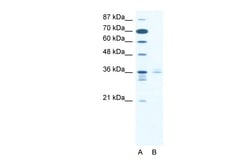 Aviva Systems Biology Corp LHX3 Antibody - middle region (ARP32443_T100)