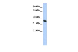 Aviva Systems Biology Corp LHX3 Antibody - middle region (ARP32444_P050)