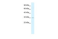 Aviva Systems Biology Corp PSMD14 Antibody - C-terminal region (ARP32449_P050)