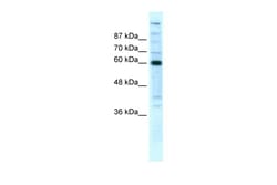 Aviva Systems Biology Corp POLR2B Antibody - N-terminal region (ARP32457_T100)