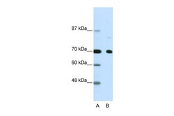Aviva Systems Biology Corp NCOR2 Antibody - N-terminal region (ARP32464_T100)