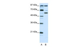 Aviva Systems Biology Corp PCAF Antibody - N-terminal region (ARP32466_T100)