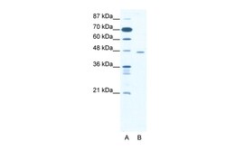 Aviva Systems Biology Corp CTBP1 Antibody - C-terminal region (ARP32468_T100)