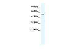 Aviva Systems Biology Corp SUV39H1 Antibody - C-terminal region (ARP32470_T100)