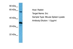 Aviva Systems Biology Corp SRC Antibody - N-terminal region (ARP32476_P050)