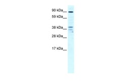 Aviva Systems Biology Corp ZC3H7B Antibody - N-terminal region (ARP32500_T100)