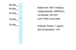 Aviva Systems Biology Corp HEY1 Antibody - C-terminal region (ARP32512_T100)