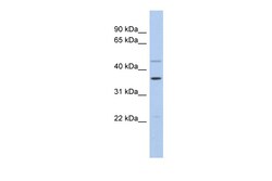 Aviva Systems Biology Corp FOS Antibody - middle region (ARP32517_P050)
