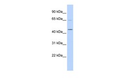 Aviva Systems Biology Corp MIZF Antibody - middle region (ARP32543_P050)