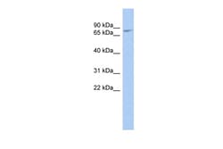Aviva Systems Biology Corp ZBTB20 Antibody - middle region (ARP32545_P050)