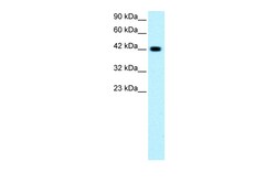 Aviva Systems Biology Corp GATA3 Antibody - C-terminal region (ARP32548_P050)
