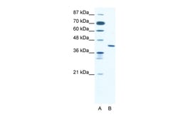 Aviva Systems Biology Corp ZNF621 Antibody - middle region (ARP32582_T100)