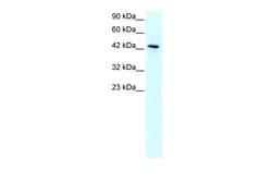 Aviva Systems Biology Corp KLF15 Antibody - N-terminal region (ARP32587_T100)