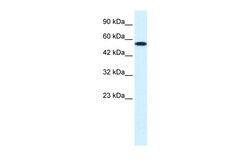 Aviva Systems Biology Corp CHEK1 Antibody - middle region (ARP32589_P050)