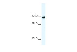 Aviva Systems Biology Corp GRM6 Antibody - C-terminal region (ARP32597_P050)