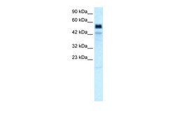 Aviva Systems Biology Corp TBX21 Antibody - middle region (ARP32612_P050)