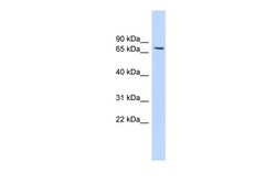 Aviva Systems Biology Corp HDAC2 Antibody - middle region (ARP32619_P050)