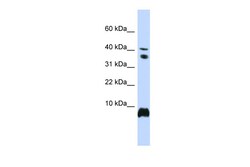 Aviva Systems Biology Corp HMGN1 Antibody - middle region (ARP32627_P050)