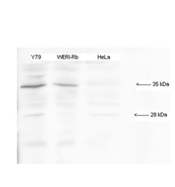 Aviva Systems Biology Corp HMX1 Antibody - middle region (ARP32629_P050)