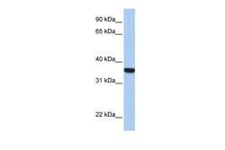 Aviva Systems Biology Corp HOXD1 Antibody - C-terminal region (ARP32644_P050)