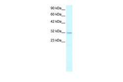 Aviva Systems Biology Corp APEX1 Antibody - N-terminal region (ARP32651_T100)