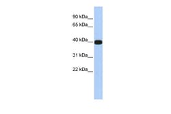 Aviva Systems Biology Corp LMX1A Antibody - N-terminal region (ARP32673_P050)