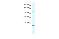 Aviva Systems Biology Corp TSFM Antibody - N-terminal region (ARP32675_P050)