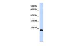 Aviva Systems Biology Corp YAF2 Antibody - middle region (ARP32676_P050)