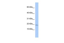 Aviva Systems Biology Corp MAFG Antibody - middle region (ARP32691_P050)
