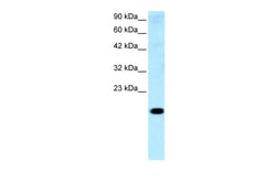 Aviva Systems Biology Corp CITED1 Antibody - middle region (ARP32705_P050)