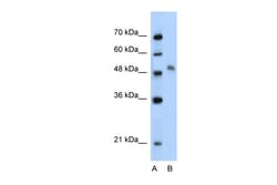 Aviva Systems Biology Corp MYBL1 Antibody - middle region (ARP32707_T100)