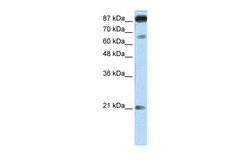 Aviva Systems Biology Corp NFATC4 Antibody - middle region (ARP32715_T100)