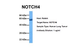 Aviva Systems Biology Corp NOTCH4 Antibody - middle region (ARP32726_P050)