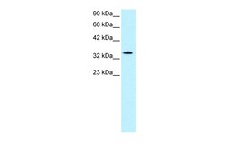 Aviva Systems Biology Corp PAWR Antibody - middle region (ARP32735_T100)