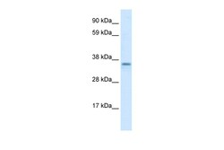 Aviva Systems Biology Corp CGI-62 Antibody - C-terminal region (ARP32751_T100)