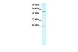 Aviva Systems Biology Corp ZNFN1A1 Antibody - middle region (ARP32757_P050)