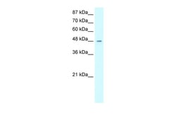 Aviva Systems Biology Corp HMG20A Antibody - middle region (ARP32759_P050)