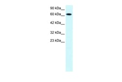 Aviva Systems Biology Corp PIAS3 Antibody - C-terminal region (ARP32762_T100)