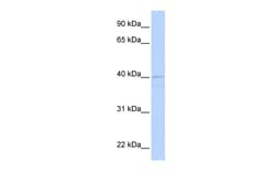 Aviva Systems Biology Corp CREB3 Antibody - middle region (ARP32768_P050)