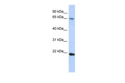 Aviva Systems Biology Corp FSBP Antibody - C-terminal region (ARP32781_P050)