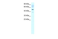 Aviva Systems Biology Corp ACAT2 Antibody - middle region (ARP32790_T100)