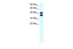 Aviva Systems Biology Corp ACAT2 Antibody - middle region (ARP32791_T100)