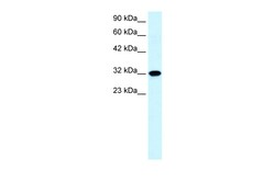 Aviva Systems Biology Corp AQP7 Antibody - C-terminal region (ARP32802_P050)