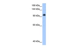 Aviva Systems Biology Corp PPP1R13L Antibody - middle region (ARP32826_P050)