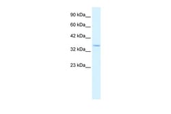 Aviva Systems Biology Corp COPS5 Antibody - N-terminal region (ARP32834_P050)