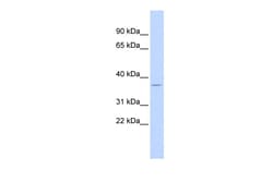 Aviva Systems Biology Corp DUSP12 Antibody - N-terminal region (ARP32856_P050)