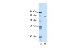 Aviva Systems Biology Corp ARID3A Antibody - middle region (ARP32869_P050)